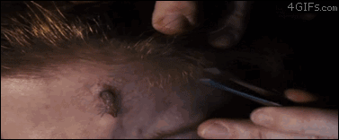 tPw1kb4.gif